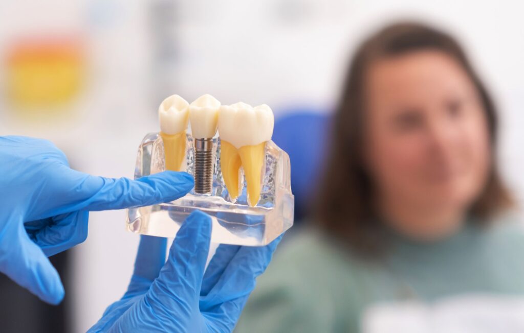 Dental Implants